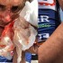 Yoann Offredo agressé : Les cyclistes face au règne de la violence !