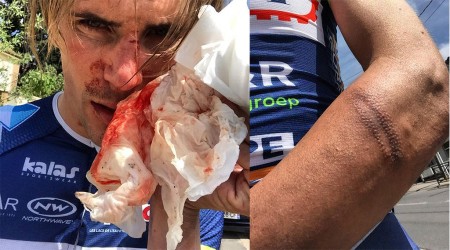 Image de l'actualité Yoann Offredo agressé : Les cyclistes face au règne de la violence !