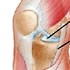 Les blessures du cycliste